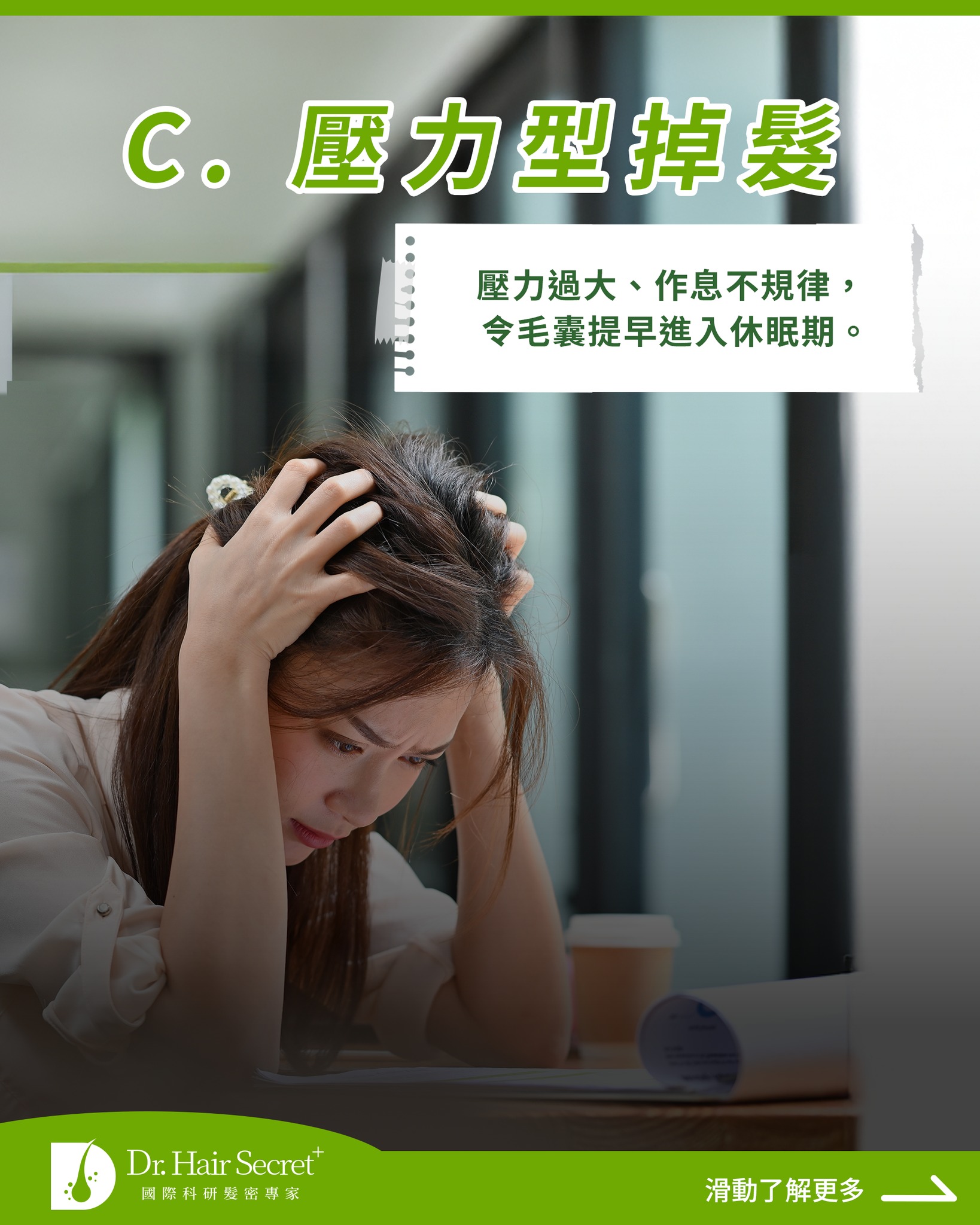 B. 髮線後移型